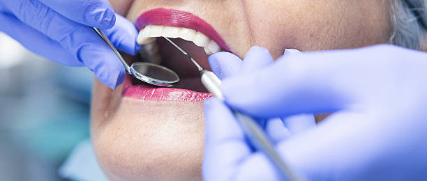 Best Emergency Dental Care for Broken or Chipped Teeth in Orangetree, FL