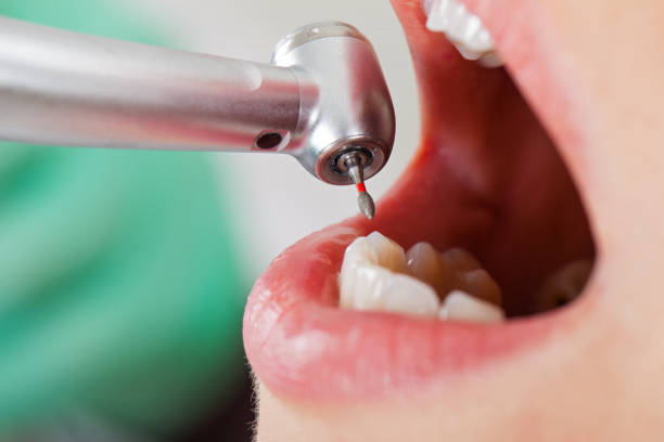Best Emergency TMJ Treatment in Orangetree, FL